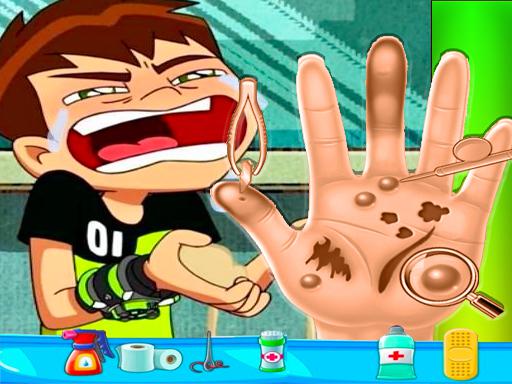 Play Ben10 Hand Doctor - Free Online Game Online