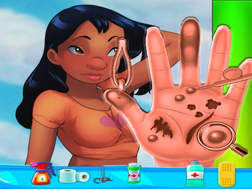 Play Nani Pelekai Hand Doctor Game Online Online