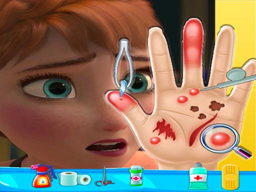 Play Anna frozen Hand Doctor: Fun Games for Girls Onlin Online